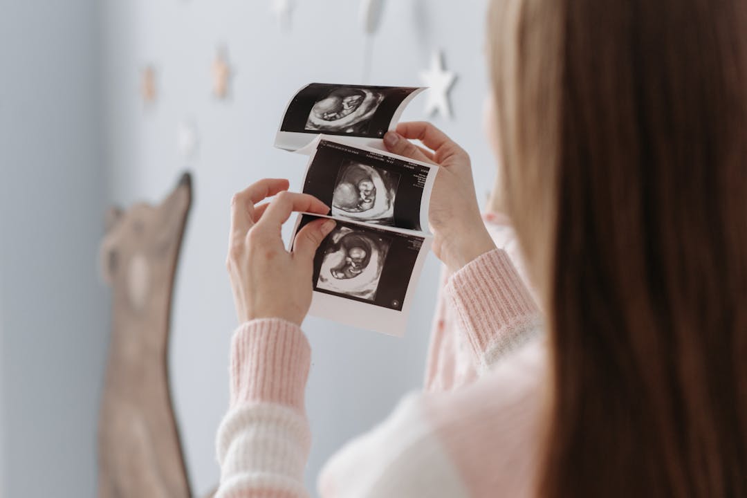 Kehamilan Minggu ke-12: Perkembangan Refleks Bayi dan Persiapan Trimester Kedua